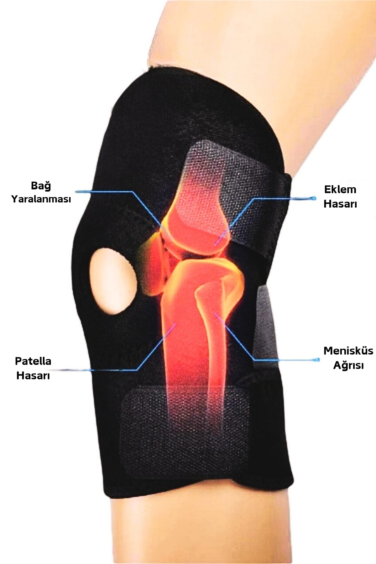 Patella ve Ligament Destekli Medikal Sporcu Dizliği - FixiCure